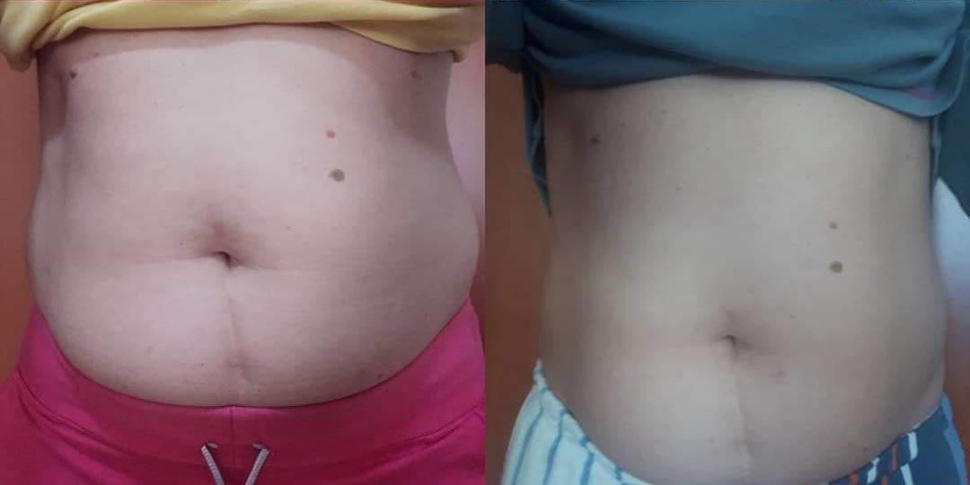 BEFORE & AFTER