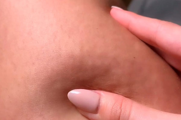 Pilula 2