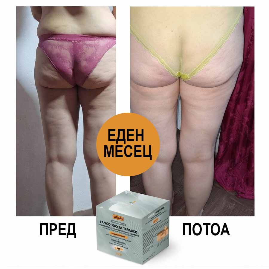 Кажете му збогу на упорниот целулит за само 1 месец!